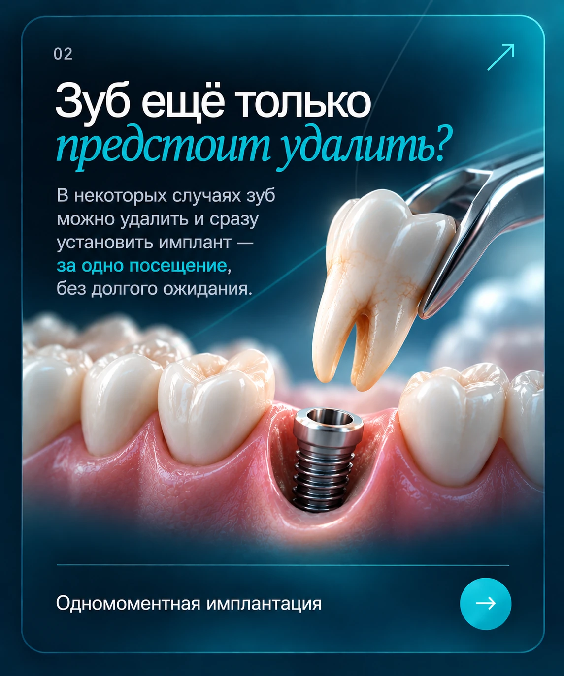 Зуб ещё только предстоит удалить? Одномоментная имплантация